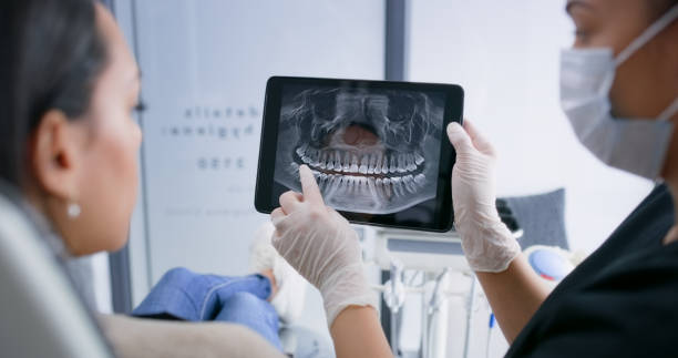 Licensed Tooth Extraction service in Ville Platte, LA - Smile Center Dentistry